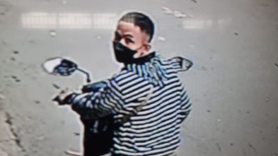 Satpam Heroik ini Dapatkan 12 Jaitan Usai Kejar Pelaku Pencuri Motor