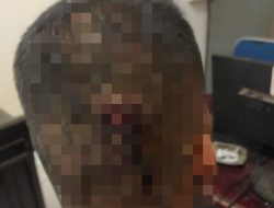 Terungkap, Bentrokan Besar di Ciomas Disebabkan Saling Senggol di THM