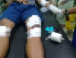 Pulang Kerja, Remaja Asal Cileungsi Ini Dicelurit Begal