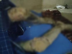 Guru Ngaji di Pamijahan Ini Alami Penyakit Kulit Aneh, Mohon Pemkab Bogor Segera Bantu