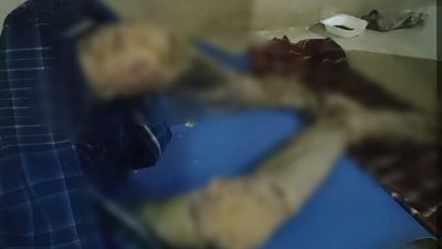 Guru Ngaji di Pamijahan Ini Alami Penyakit Kulit Aneh, Mohon Pemkab Bogor Segera Bantu