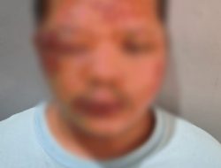 RS Warga Tanah Sareal Kota Bogor Diduga Jadi Korban Penganiayaan OTK, Korban Dikeroyok di Depan Isteri dan Anak