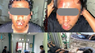 Kepergok Curi Kotak Amal Masjid di Cileungsi, 2 Pria ini Bonyok